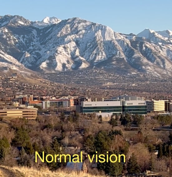 Normal vision